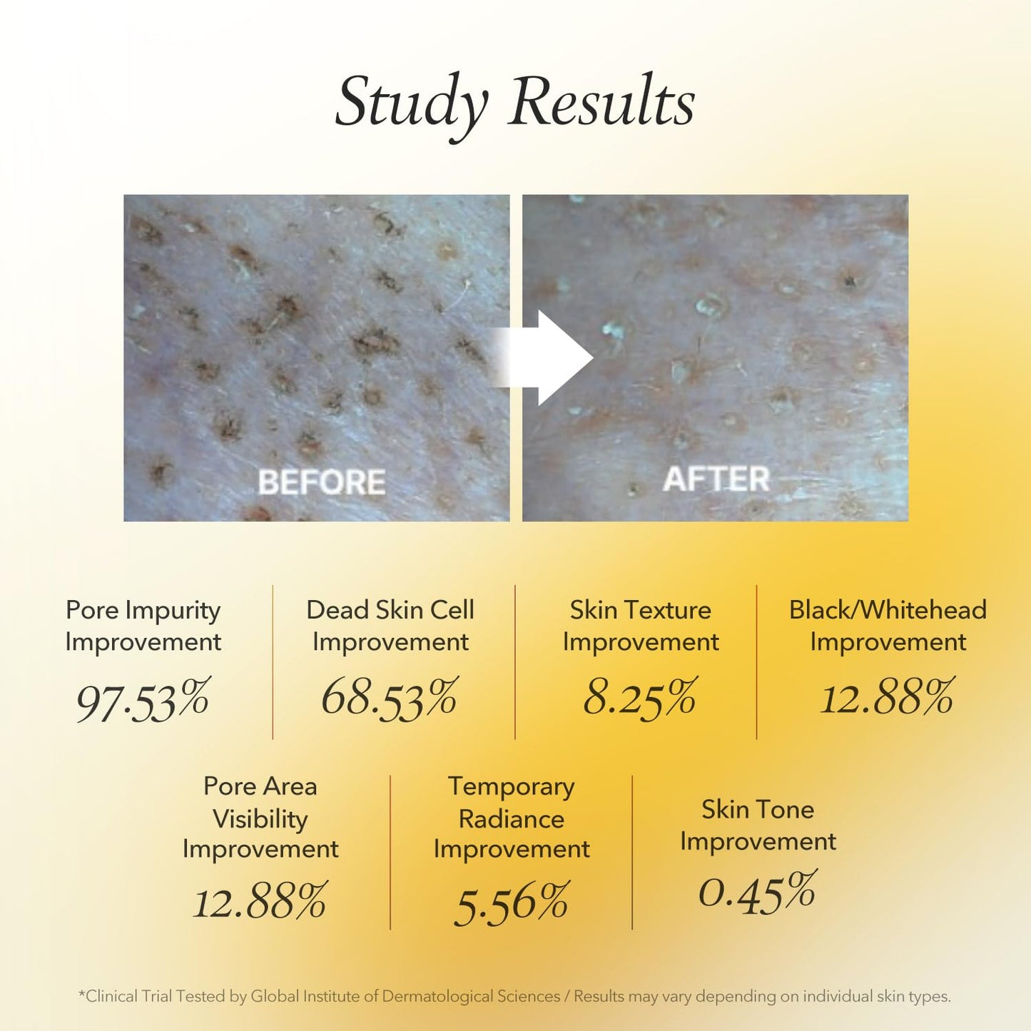 April Skin Calendula Peel Off Mask 100g